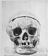 Beethoven's Skull